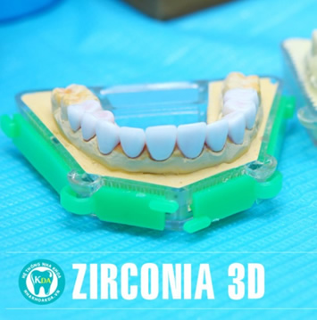 Zirconia 3D